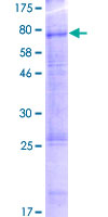 Recombinant Human RST protein