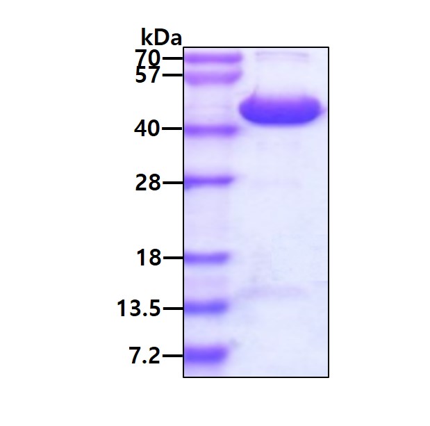 SDS-PAGE - Recombinant Human RTCD1 protein (AB181893)