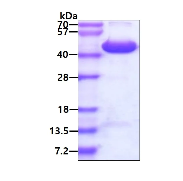 SDS-PAGE - Recombinant Human RTCD1 protein (His tag N-Terminus) (AB181893)
