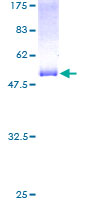 SDS-PAGE - Recombinant Human RTN3/HAP protein (GST tag N-Terminus) (AB153066)