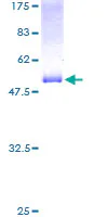 SDS-PAGE - Recombinant Human RTN3/HAP protein (GST tag N-Terminus) (AB153066)