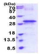 SDS-PAGE - Recombinant Human RTP4 protein (Cytoplasmic domain) (His tag N-Terminus) (AB187417)