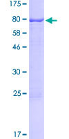SDS-PAGE - Recombinant Human RTR protein (AB114813), expandable thumbnail