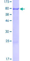 SDS-PAGE - Recombinant Human RTR protein (GST tag N-Terminus) (AB114813)