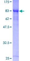 SDS-PAGE - Recombinant Human RUNX1T1/ETO/CDR protein (AB152255), expandable thumbnail