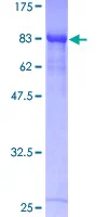 SDS-PAGE - Recombinant Human RUNX1T1/ETO/CDR protein (GST tag N-Terminus) (AB152255)