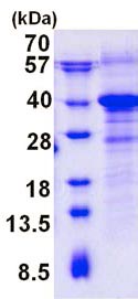 SDS-PAGE - Recombinant Human RWDD1 protein (AB139198)