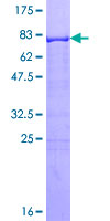 SDS-PAGE - Recombinant Human RXRG protein (AB114438), expandable thumbnail