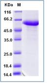 SDS-PAGE - Recombinant Human RYK protein (Fc Chimera) (AB276717)