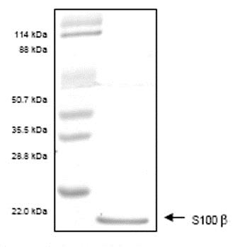 Recombinant Human S100 beta protein