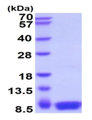 SDS-PAGE - Recombinant Human S100 beta protein (Tag Free) (AB222425)
