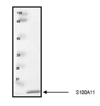 SDS-PAGE - Recombinant Human S100A11 protein (AB55569), expandable thumbnail