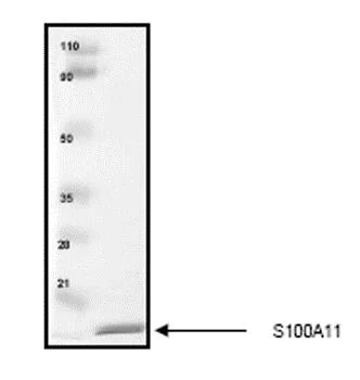 SDS-PAGE - Recombinant Human S100A11 protein (AB55569)