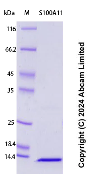 SDS-PAGE - Recombinant Human S100A11 Protein Standard (His tag) (AB323061)