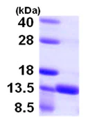 SDS-PAGE - Recombinant Human S100A16 protein (His tag N-Terminus) (AB105607)