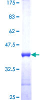 SDS-PAGE - Recombinant Human S100A3 protein (AB116969), expandable thumbnail