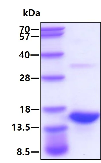 Western blot - Recombinant Human S100A9 protein (His tag C-Terminus) (AB95909)