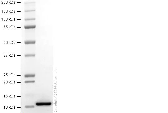 SDS-PAGE - Recombinant Human S100B Protein (His-tag) (AB317874)