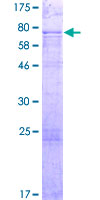 Recombinant Human S100P binding protein
