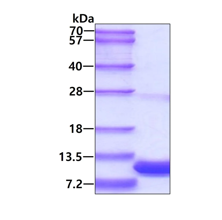 SDS-PAGE - Recombinant Human S100P protein (His tag N-Terminus) (AB95488)