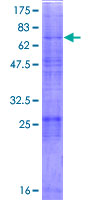 Recombinant Human S2P protein