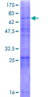 SDS-PAGE - Recombinant Human S2P protein (GST tag N-Terminus) (AB162519)