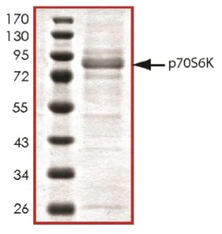 SDS-PAGE - Recombinant human S6K1 protein (Tagged-His Tag) (AB268834)
