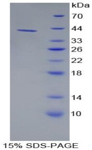 Recombinant human Salivary Alpha Amylase protein