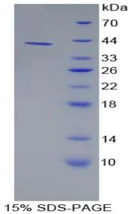 SDS-PAGE - Recombinant human Salivary Alpha Amylase protein (AB315375)