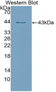 Western blot - Recombinant human Salivary Alpha Amylase protein (AB315375)