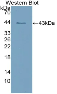 Western blot - Recombinant human Salivary Alpha Amylase protein (AB315375)