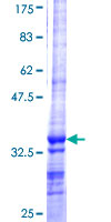 SDS-PAGE - Recombinant Human Salivary alpha amylase protein (GST tag N-Terminus) (AB157886)