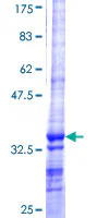 SDS-PAGE - Recombinant Human Salivary alpha amylase protein (AB157886)