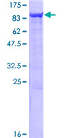 SDS-PAGE - Recombinant Human SAMHD1 protein (AB153254), expandable thumbnail