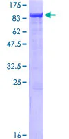 SDS-PAGE - Recombinant Human SAMHD1 protein (GST tag N-Terminus) (AB153254)