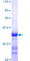 SDS-PAGE - Recombinant Human SAP97 protein (GST tag N-Terminus) (AB152336)
