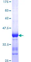 SDS-PAGE - Recombinant Human SAP97 protein (GST tag N-Terminus) (AB152336)