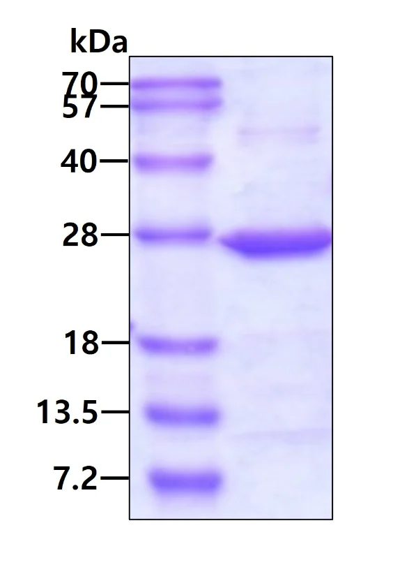 SDS-PAGE - Recombinant Human SAR1 protein (His tag N-Terminus) (AB87626)