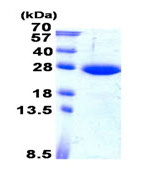 SDS-PAGE - Recombinant Human SAR1B protein (AB139612), expandable thumbnail