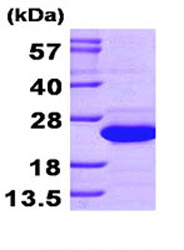 SDS-PAGE - Recombinant Human SAT1 protein (His tag N-Terminus) (AB87666)