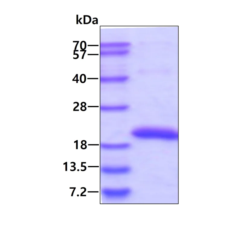 SDS-PAGE - Recombinant Human SAT2 protein (His tag N-Terminus) (AB124307)