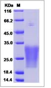 SDS-PAGE - Recombinant Human SBEM protein (His tag) (AB276685)