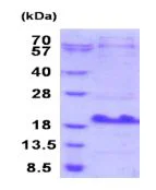 SDS-PAGE - Recombinant Human SBEM protein (His tag N-Terminus) (AB187461)