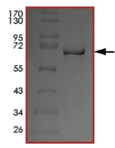 SDS-PAGE - Recombinant human SBK1 protein (AB204137)