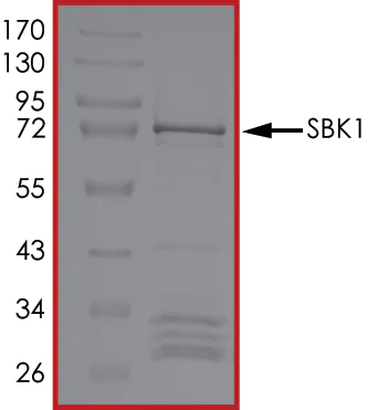 SDS-PAGE - Recombinant human SBK1 protein (AB204137)
