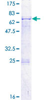 SDS-PAGE - Recombinant Human SCC112 protein (GST tag N-Terminus) (AB161580)