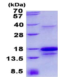 SDS-PAGE - Recombinant Human SCDGFB/PDGF-D protein (denatured) (AB134520)