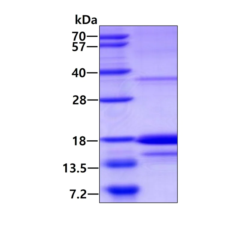 SDS-PAGE - Recombinant Human SCDGFB/PDGF-D protein (denatured) (His tag N-Terminus) (AB134520)