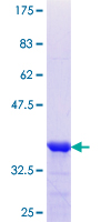 SDS-PAGE - Recombinant Human SCEL protein (AB160194), expandable thumbnail