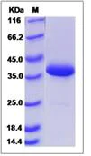 SDS-PAGE - Recombinant Human SCGB3A1 protein (Fc Chimera) (AB276538)